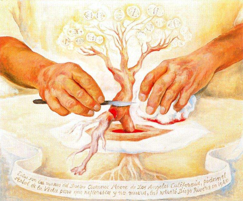 The Hands of Dr Moore — Диего Ривера